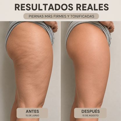CelluFit™ – Shorts 3D Anticelulíticos y Moldeadores